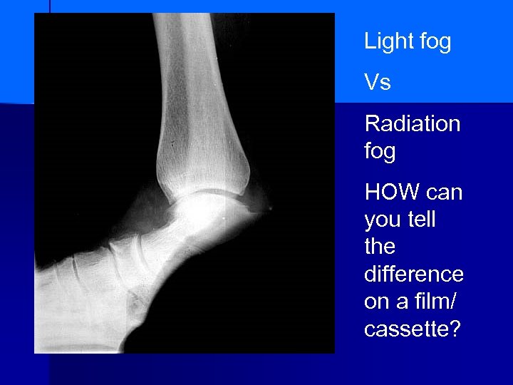 Light fog Vs Radiation fog HOW can you tell the difference on a film/