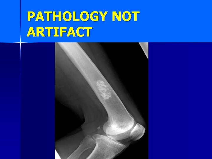 PATHOLOGY NOT ARTIFACT 