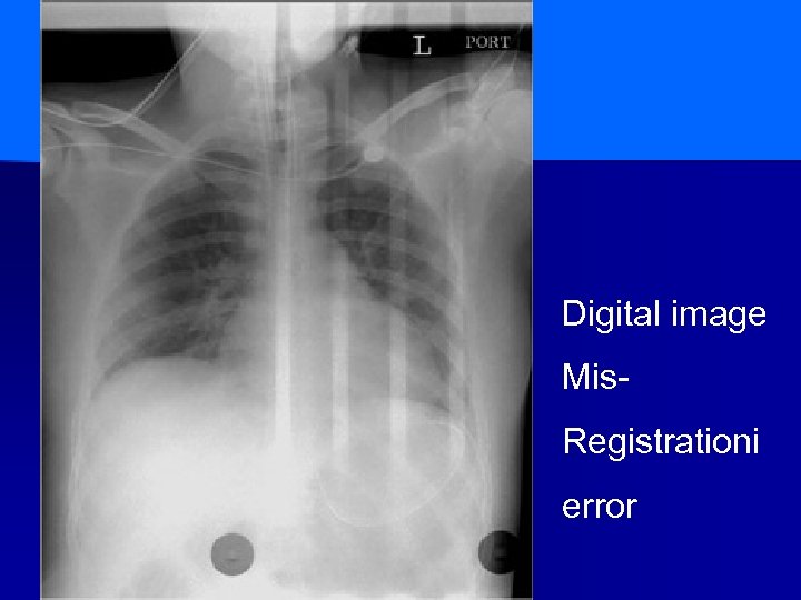 Digital image Mis. Registrationi error 