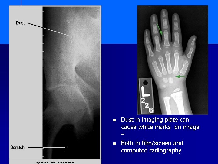 n n Dust in imaging plate can cause white marks on image – Both