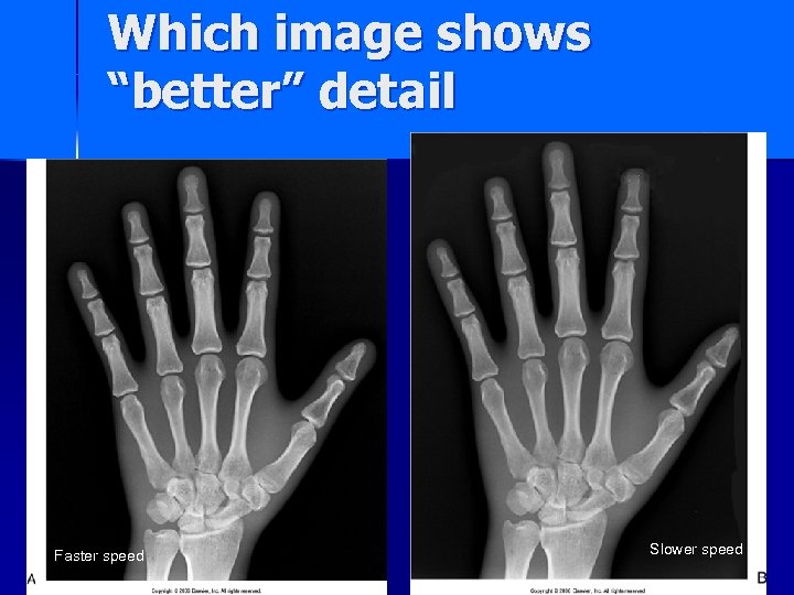 Which image shows “better” detail Faster speed Slower speed 