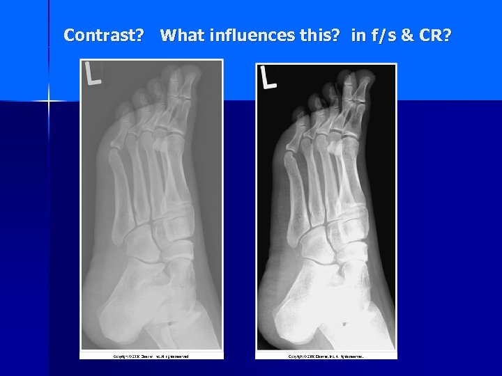 Contrast? What influences this? in f/s & CR? 