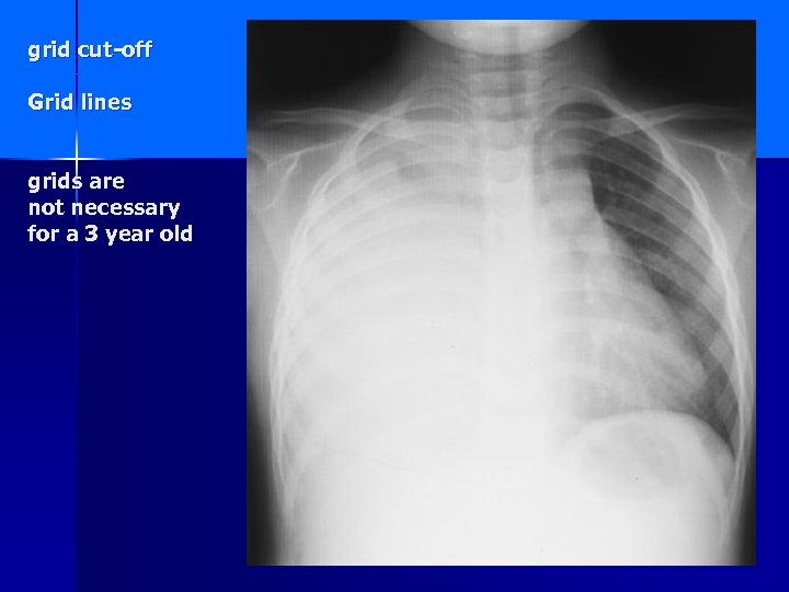 grid cut-off Grid lines grids are not necessary for a 3 year old 