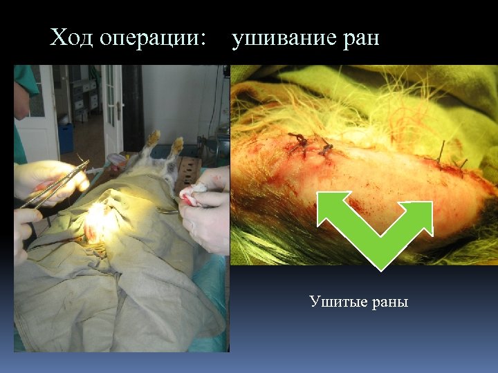 Ход операции: ушивание ран Ушитые раны 
