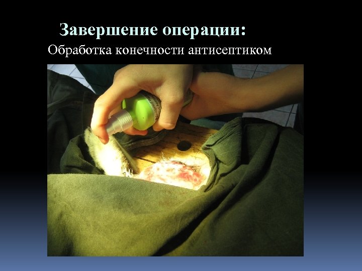 Завершение операции: Обработка конечности антисептиком 