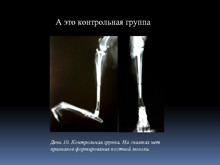 А это контрольная группа День 10. Контрольная группа. На снимках нет признаков формирования костной