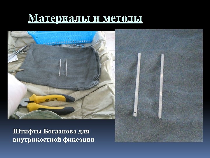 Материалы и методы Штифты Богданова для внутрикостной фиксации 