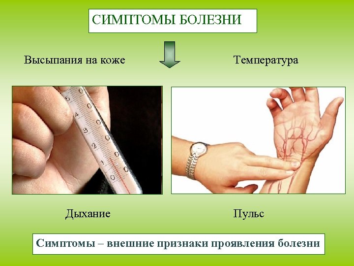 СИМПТОМЫ БОЛЕЗНИ Высыпания на коже Дыхание Температура Пульс Симптомы – внешние признаки проявления болезни