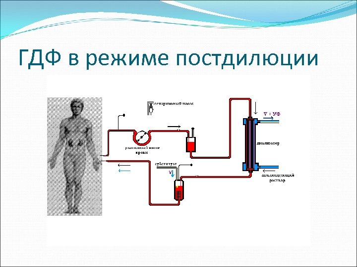 ГДФ в режиме постдилюции 