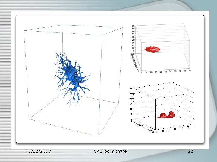 01/12/2008 CAD polmonare 22 