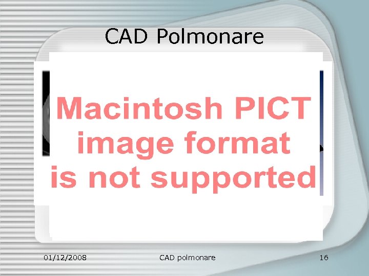 CAD Polmonare 01/12/2008 CAD polmonare 16 