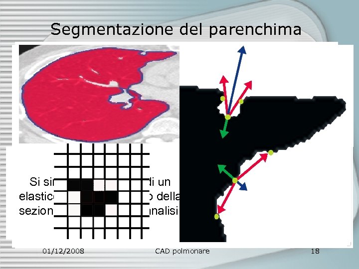 Segmentazione del parenchima Tramite un region growing si accresce la Hull? Convex regione interna
