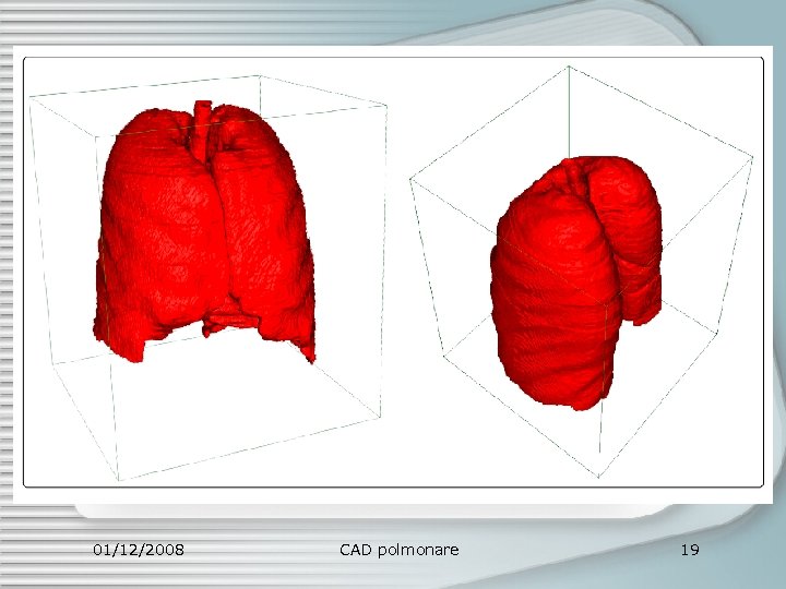 01/12/2008 CAD polmonare 19 