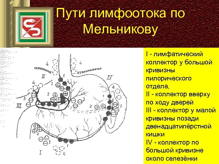 Пути лимфоотока по Мельникову I - лимфатический коллектор у большой кривизны пилорического отдела, II