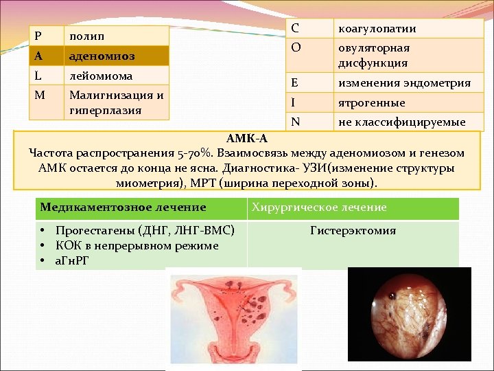 P полип A аденомиоз L лейомиома M Малигнизация и гиперплазия C коагулопатии O овуляторная