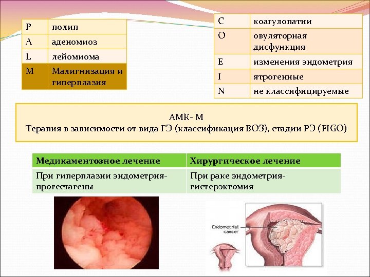 P полип A аденомиоз L лейомиома M Малигнизация и гиперплазия C коагулопатии O овуляторная