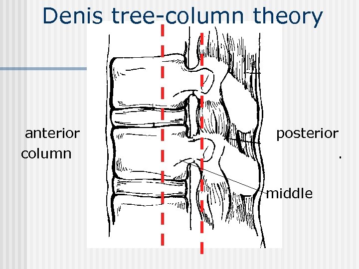 Denis tree-column theory anterior column posterior. middle 