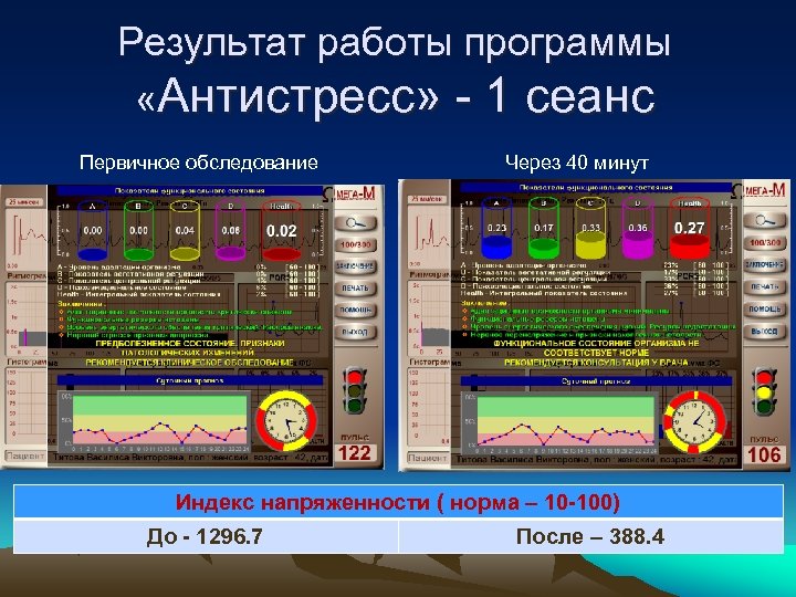 Результат работы программы «Антистресс» - 1 сеанс Первичное обследование Через 40 минут Индекс напряженности