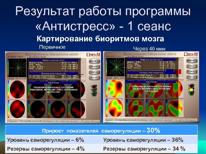 Результат работы программы «Антистресс» - 1 сеанс Картирование биоритмов мозга Первичное Через 40 мин