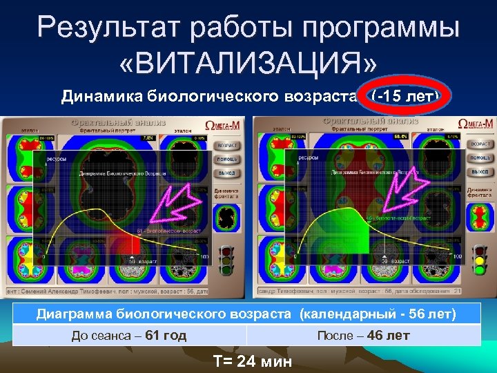 Результат работы программы «ВИТАЛИЗАЦИЯ» Динамика биологического возраста (-15 лет) Диаграмма биологического возраста (календарный -