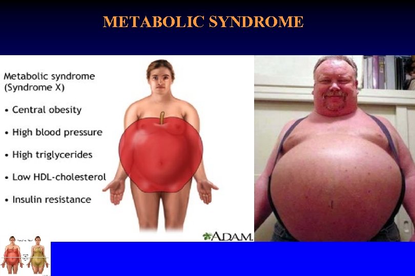 METABOLIC SYNDROME 