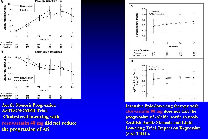 Aortic Stenosis Progression : ASTRONOMER Trial. Cholesterol lowering with rosuvastatin 40 mg did not