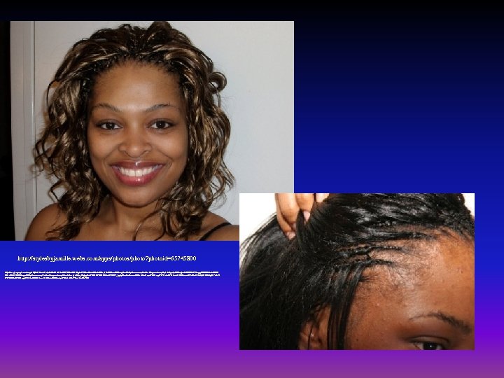 http: //stylesbyjamille. webs. com/apps/photo? photoid=65745800 http: //images. google. com/imgres? q=tree+braids+styles&hl=en&biw=1024&bih=619&gbv=2&tbm=isch&tbnid=Dkap 13 ZK 90 cnn.