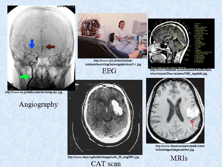 http: //www. ukb. de/de/klinikeninstitute/neuro/img/leistungsspektrum 3 -1. jpg EEG http: //www. meddean. luc. edu/lumen/Med. Ed/Radi