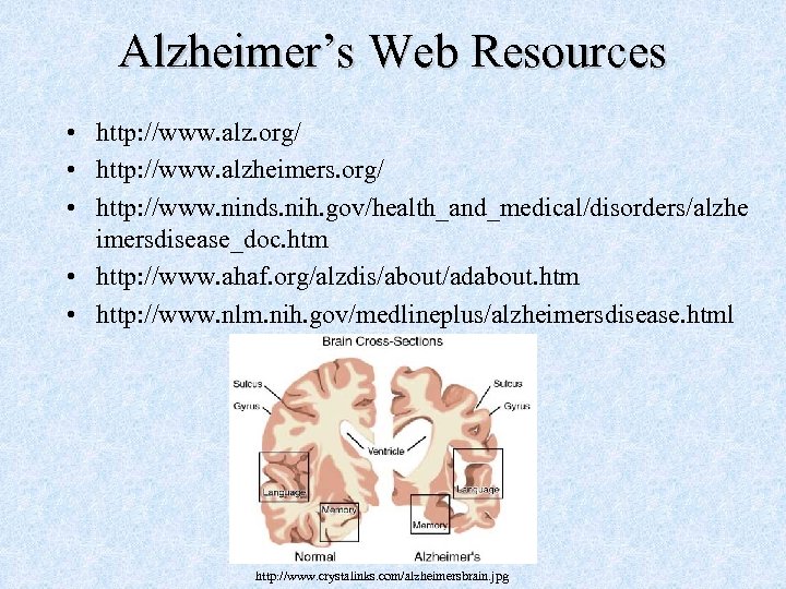 Alzheimer’s Web Resources • http: //www. alz. org/ • http: //www. alzheimers. org/ •