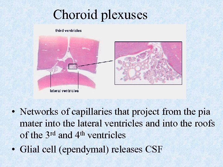 Choroid plexuses • Networks of capillaries that project from the pia mater into the