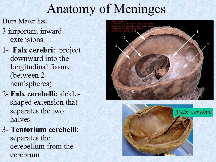 Anatomy of Meninges Dura Mater has 3 important inward extensions 1 - Falx cerebri: