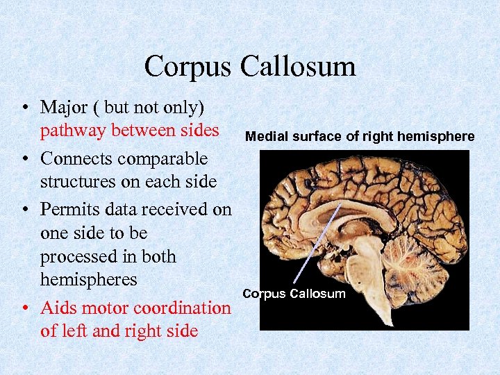 Corpus Callosum • Major ( but not only) pathway between sides Medial surface of