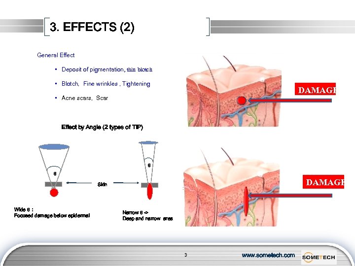 3. EFFECTS (2) General Effect • Deposit of pigmentation, thin blotch • Blotch, Fine