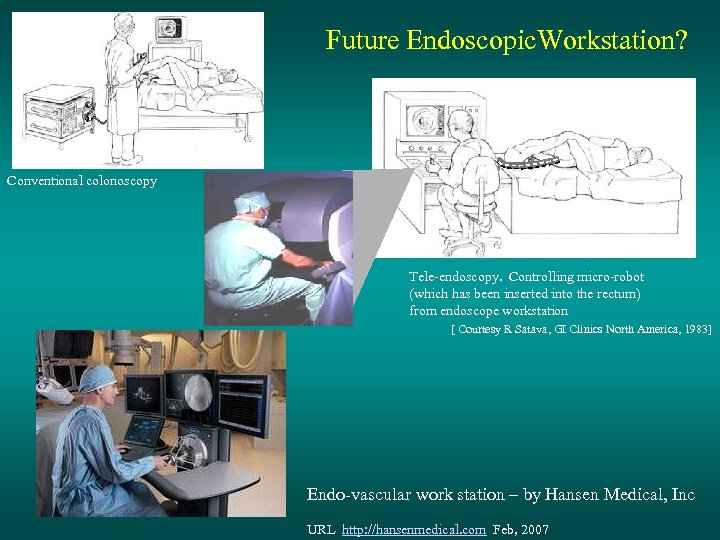 Future Endoscopic. Workstation? Conventional colonoscopy Tele-endoscopy. Controlling micro-robot (which has been inserted into the