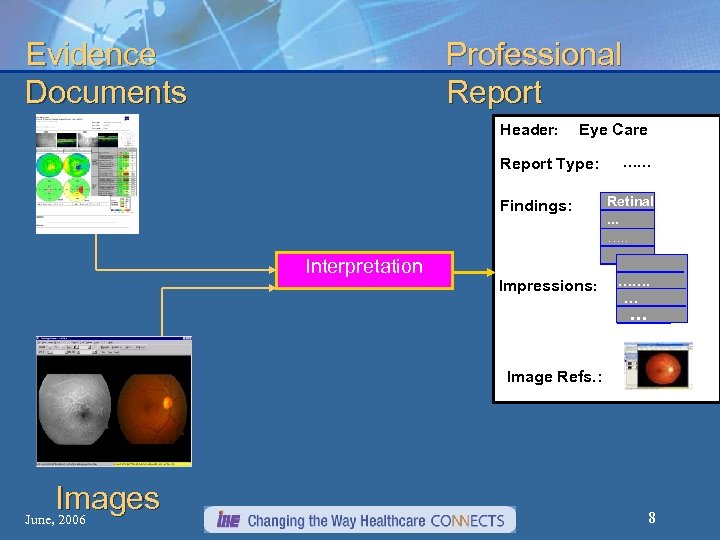 Evidence Documents Professional Report Header: Eye Care Report Type: Findings: Interpretation Impressions: …… ….
