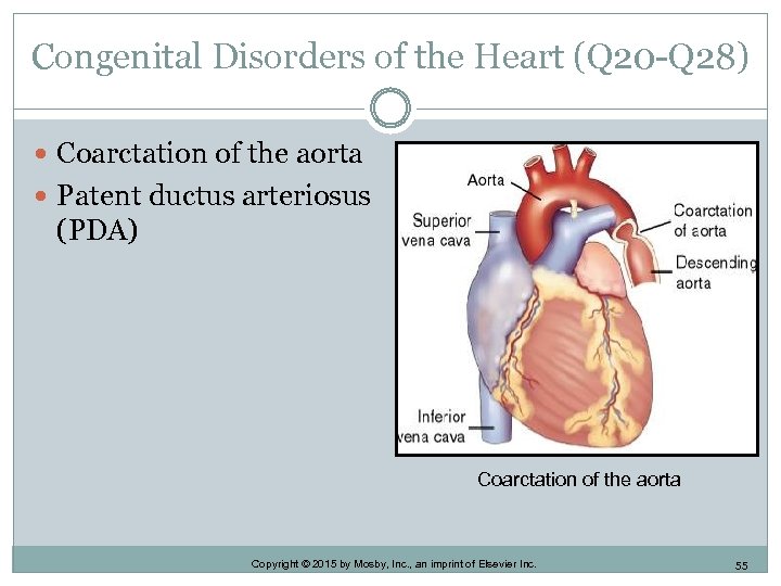 Congenital Disorders of the Heart (Q 20 -Q 28) Coarctation of the aorta Patent