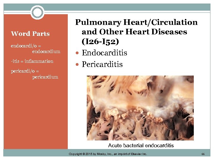 Word Parts endocardi/o = endocardium -itis = inflammation pericardi/o = pericardium Pulmonary Heart/Circulation and