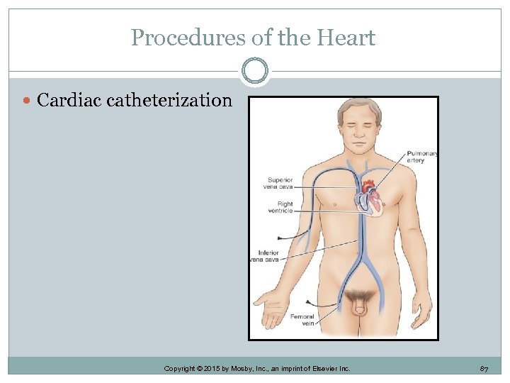 Procedures of the Heart Cardiac catheterization Copyright © 2015 by Mosby, Inc. , an