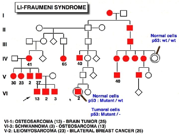 Синдром ли. Li Fraumeni Syndrome. Синдром ли-Фраумени. Тр53 ген. Синдром ли-Фраумени онкоген.