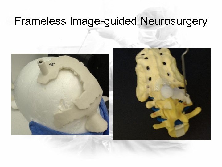 Frameless Image-guided Neurosurgery 