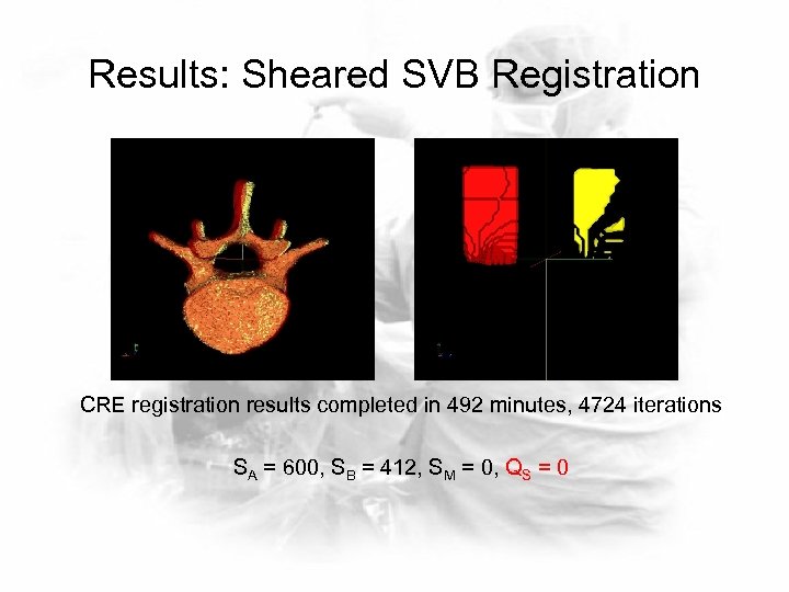 Results: Sheared SVB Registration CRE registration results completed in 492 minutes, 4724 iterations SA