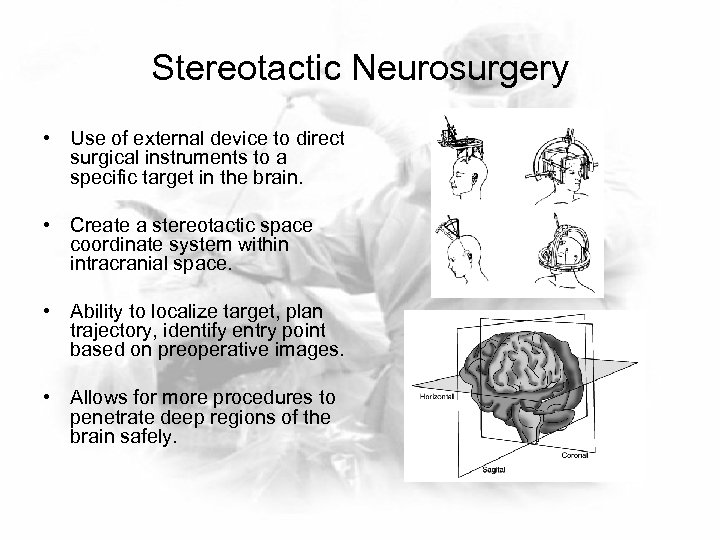 Stereotactic Neurosurgery • Use of external device to direct surgical instruments to a specific