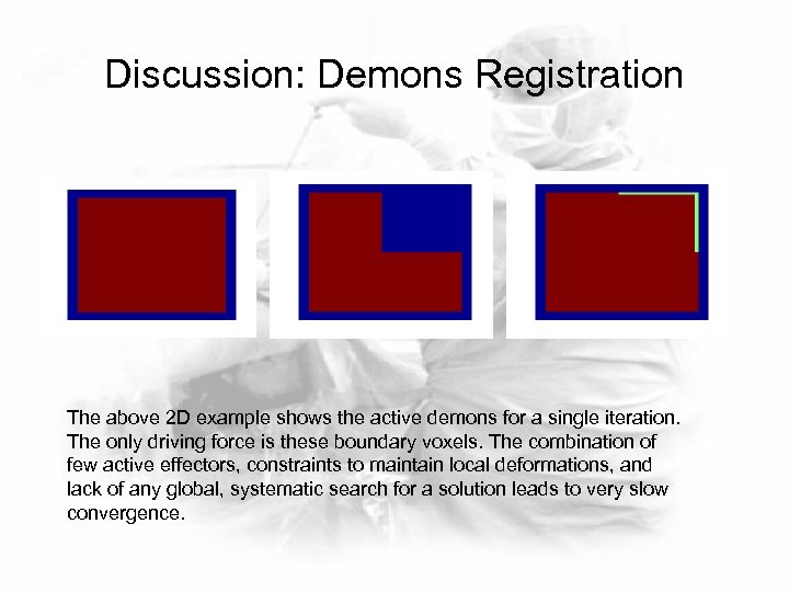 Discussion: Demons Registration The above 2 D example shows the active demons for a