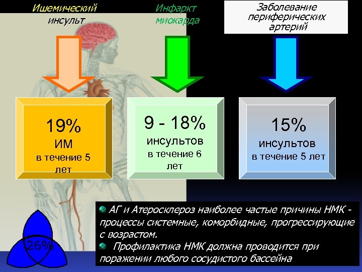 Ишемический инсульт Инфаркт миокарда Заболевание периферических артерий 19% 9 - 18% 15% ИМ в