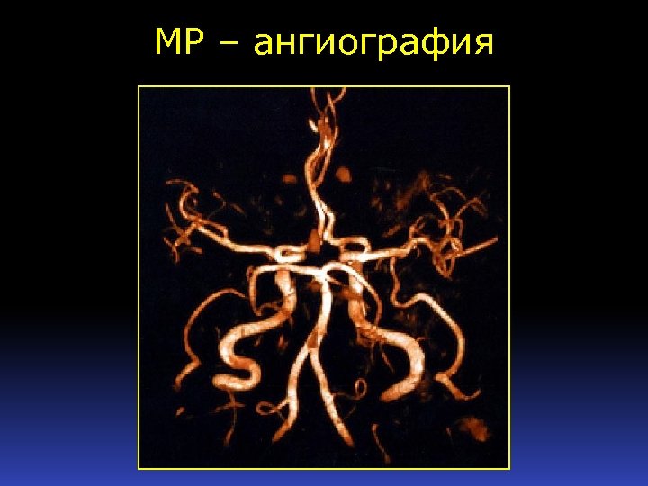 МР – ангиография 