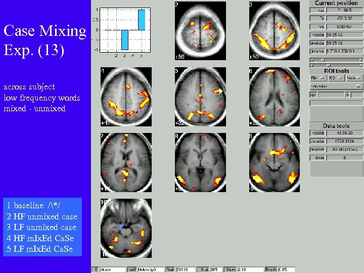 Case Mixing Exp. (13) across subject low frequency words mixed - unmixed 1 baseline
