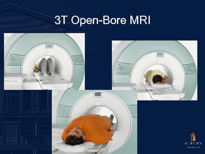 3 T Open-Bore MRI 