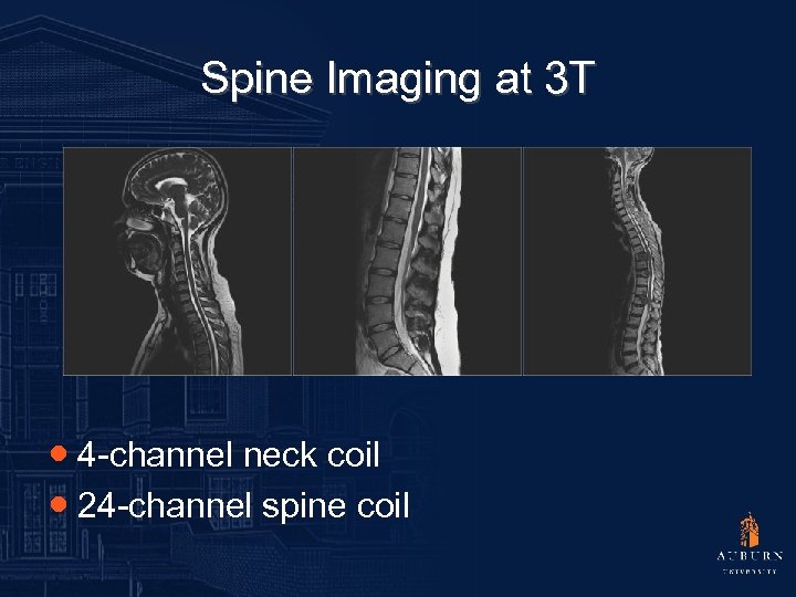 Spine Imaging at 3 T ● 4 -channel neck coil ● 24 -channel spine