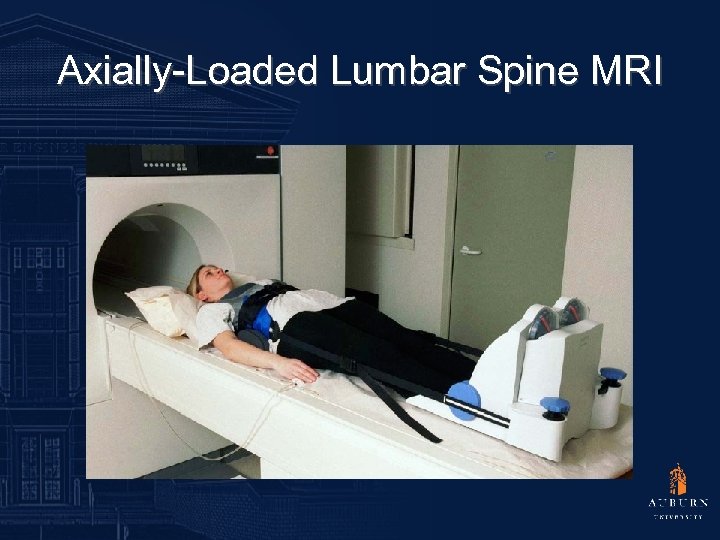 Axially-Loaded Lumbar Spine MRI 