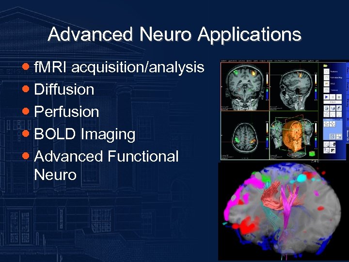 Advanced Neuro Applications ● f. MRI acquisition/analysis ● Diffusion ● Perfusion ● BOLD Imaging